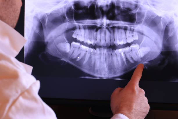 Best Knocked-Out Tooth Emergency  in Grove, OK