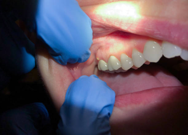Best Tooth Pain Emergency Relief  in Grove, OK